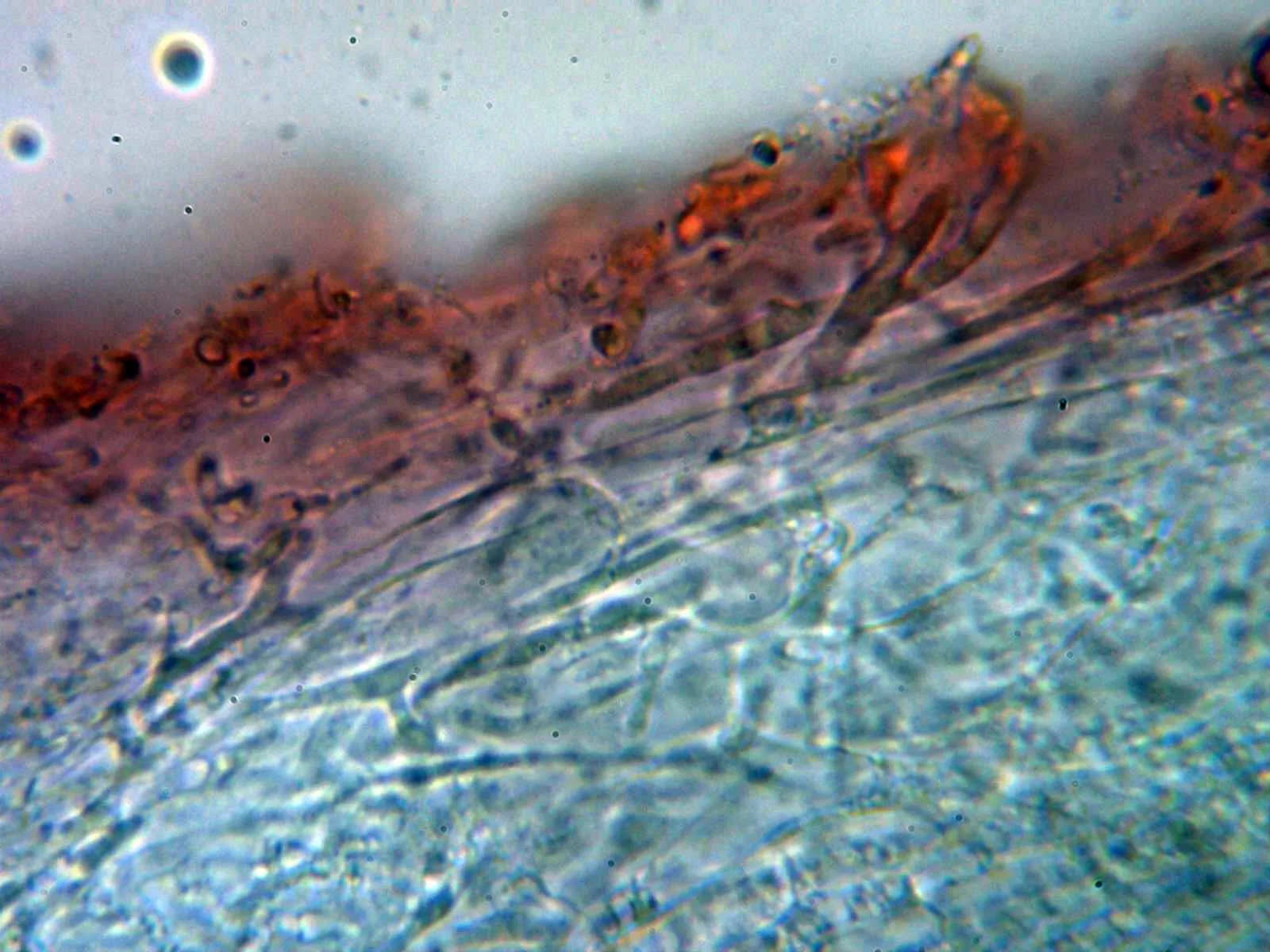 Microscopía de Mycena leptocephala - 10 - Suprapellis 2